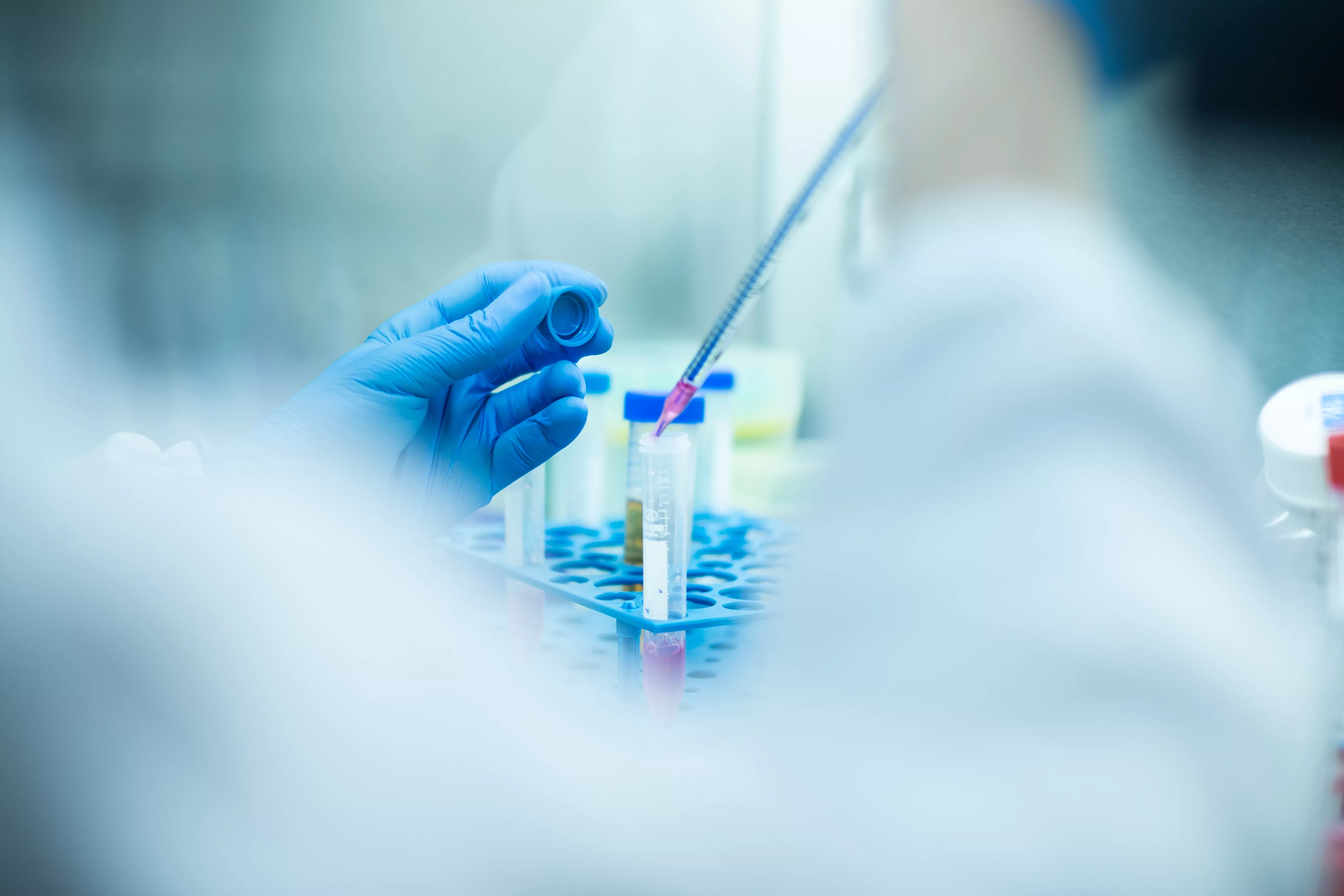 Laboratory work with pipette and test tubes, representing Essential Pharma’s role in supplying essential medicines worldwide.